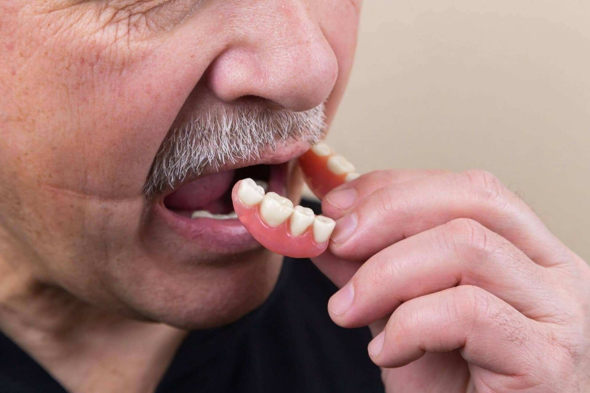 Navigating Affordable Dental Implants for Seniors in the USA